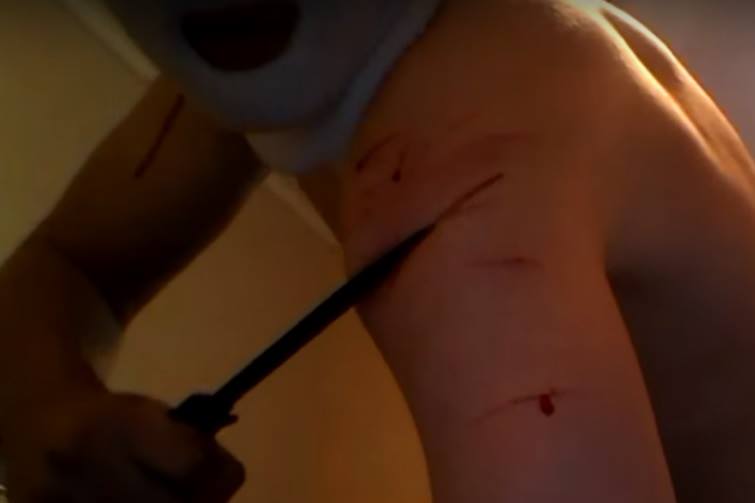 A close-up photograph showing a person's upper arm being cut with a knife. Several bleeding horizontal incisions are visible on the skin. The person's face is partially obscured by a white mask.